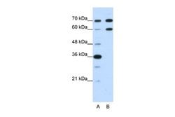 DMRT2 Rabbit anti-Human, Polyclonal, Novus Biologicals 0.1 mL | Buy Online | Novus Biologicals | Fisher Scientific